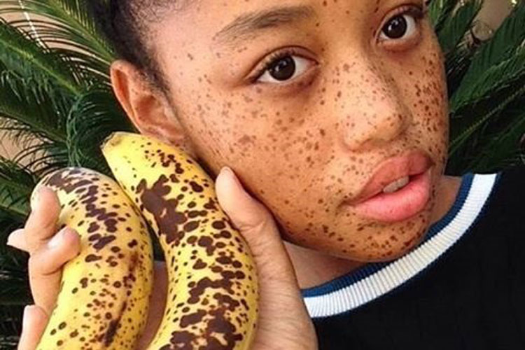 menina com sardas segurando uma banana