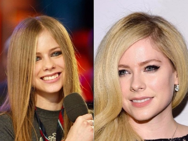 Avril Lavigne com fotos antes e depois que provam que celebridades foram substituídas