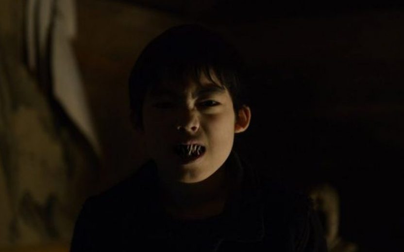 menino com dentes grandes e medonhos