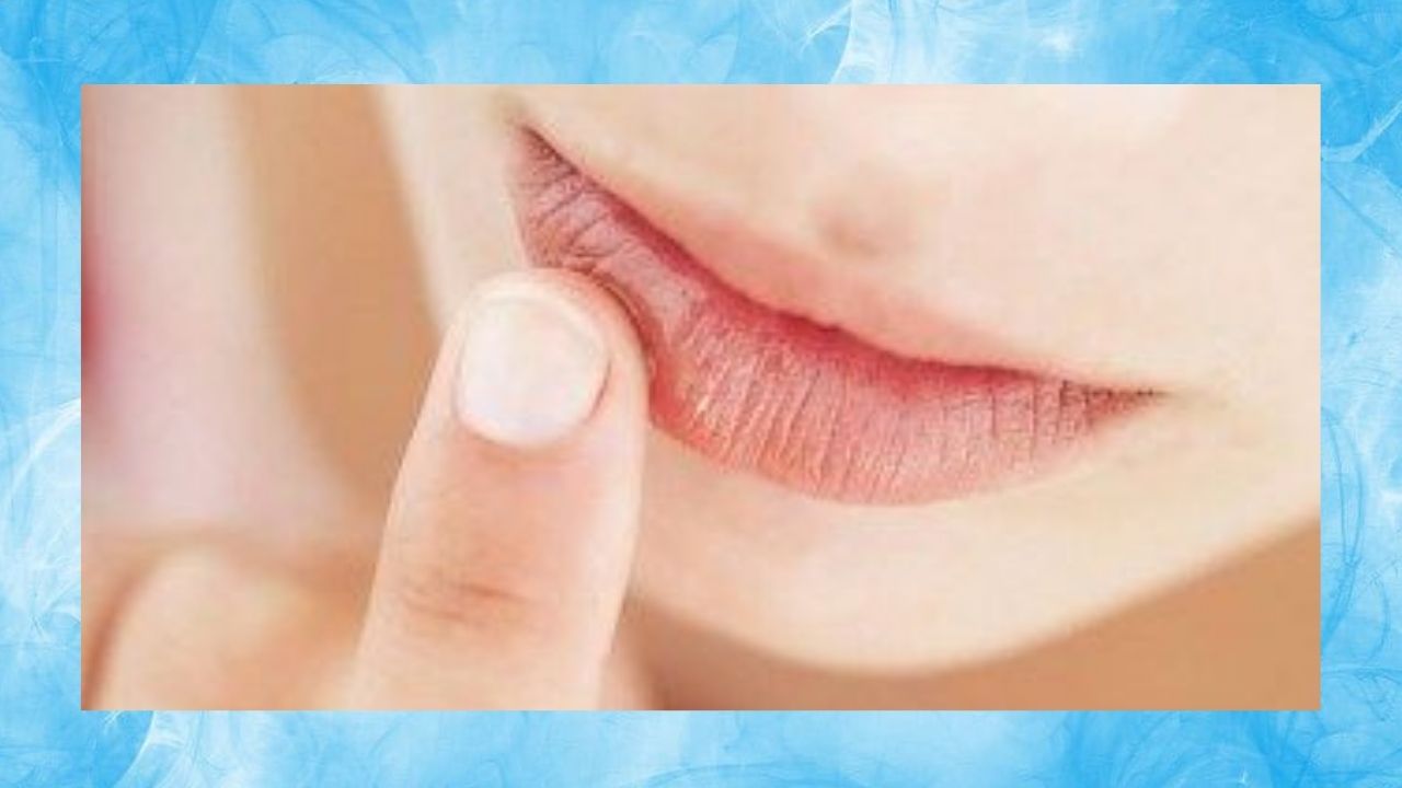 Saiba como cuidar da boca ressecada no frio