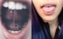 tipos de piercing na língua freio