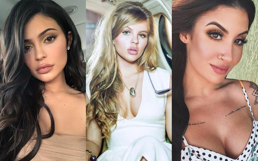 preenchimento labial