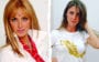 Antes e depois Anahí