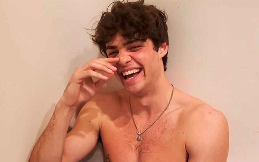 cirurgia de noah centineo