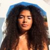 Dia mundial do vitiligo: conheça 5 influenciadoras que te inspiram a aderir ao skin positivity